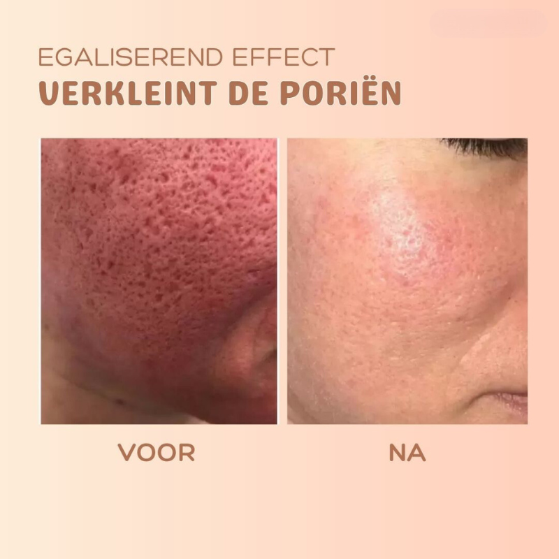 MultiBalm™ - Anti-rimpel huidvernieuwingsbalsem